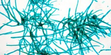 Immagine al microscopio di tessuti cellulari di piante
