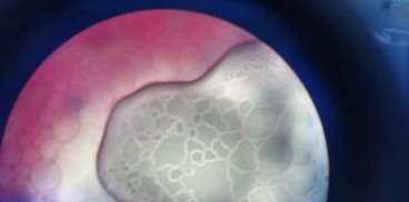 Cellule ingrandite al microscopio