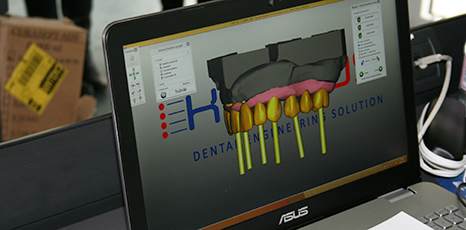 Schermo di un computer con immagine di una dentatura scansionata in 3D